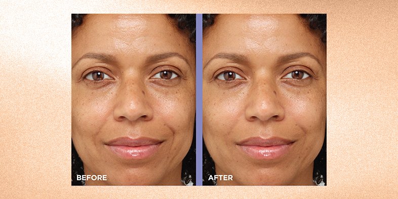 InArticleWaterBased MoisturizerRevitaLift HA Ceramides LinePlumping Water Cream